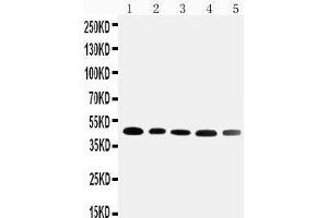Anti-Cortisol Binding Globulin antibody, Western blotting Lane 1: HELA Cell Lysate Lane 2: A431 Cell Lysate Lane 3: U87 Cell Lysate Lane 4: 22RV1 Cell Lysate Lane 5: PANC Cell Lysate
