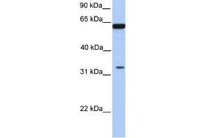 WB Suggested Anti-PERLD1 Antibody Titration:  0. (PGAP3 Antikörper  (N-Term))