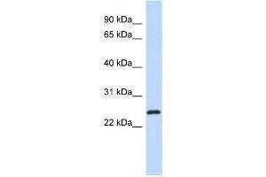Western Blotting (WB) image for anti-Kruppel-Like Factor 16 (KLF16) antibody (ABIN2457888) (KLF16 Antikörper)