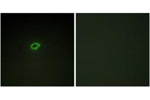 Immunofluorescence analysis of COS7 cells, using Collagen IV alpha4 Antibody.