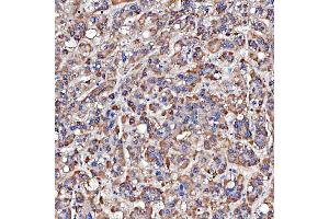 IHC analysis of TTLL2 using anti-TTLL2 antibody (ABIN7600850).