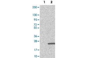 Western Blot analysis of Lane 1: negative control (vector only transfected HEK293T cell lysate) and Lane 2: over-expression lysate (co-expressed with a C-terminal myc-DDK tag in mammalian HEK293T cells) with PFDN4 polyclonal antibody . (PFDN4 Antikörper)