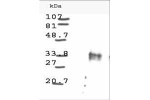 Image no. 1 for anti-Cyclin D1 (CCND1) antibody (ABIN221149) (Cyclin D1 Antikörper)