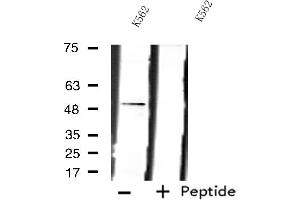 Western blot analysis of extracts from K562 cells using LPCAT2 antibody. (LPCAT2 Antikörper  (N-Term))