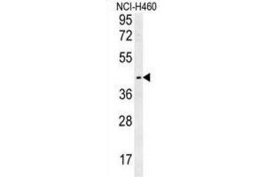Western Blotting (WB) image for anti-Lysosomal Protein Transmembrane 5 (LAPTM5) antibody (ABIN2995513)