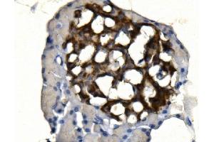 IHC analysis of SYP using anti-SYP antibody (ABIN7603120). (Synaptophysin Antikörper  (N-Term))