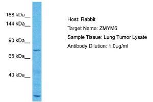 Host: Rabbit Target Name: ZMYM6 Sample Type: Lung Tumor lysates Antibody Dilution: 1. (ZMYM6 Antikörper  (N-Term))