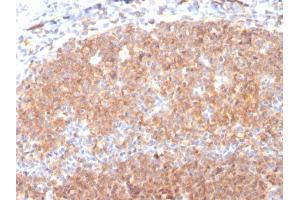 Formalin-fixed, paraffin-embedded human Tonsil stained with CD19 Monospecific Mouse Monoclonal Antibody (CD19/3117). (CD19 Antikörper  (AA 96-281))
