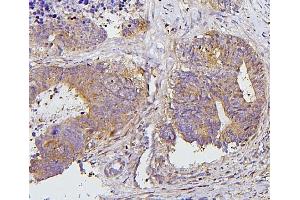 IHC analysis of PRKCD using anti-PRKCD antibody (ABIN7601631). (PKC delta Antikörper  (AA 4-676))