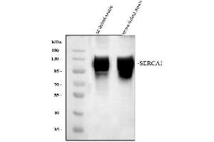 Western blot analysis of ATP2A1 using anti-ATP2A1 antibody (ABIN3043792).