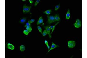 Immunofluorescence staining of MCF-7 cells with ABIN7142970 at 1:100, counter-stained with DAPI. (Acetylcholinesterase Antikörper  (AA 53-162))