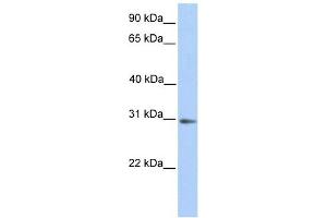 ABHD13 antibody used at 1 ug/ml to detect target protein. (ABHD13 Antikörper  (N-Term))