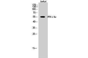 anti-PFK-2 LIV (C-Term) antibody