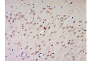 Formalin-fixed and paraffin embedded rat brain labeled with Anti-PNUTS/PPP1R10 Polyclonal Antibody, Unconjugated  at 1:200 followed by conjugation to the secondary antibody and DAB staining.