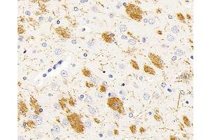 Immunohistochemistry analysis of paraffin-embedded rat brain using MBP Polyclonal Antibody at dilution of 1:500. (MBP Antikörper)