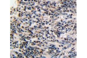 Used in DAB staining on fromalin fixed paraffin-embedded esophagus tissue (PPARG Antikörper  (AA 149-273))