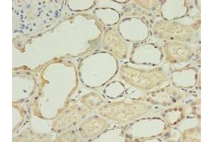 Immunohistochemistry of paraffin-embedded human kidney tissue using ABIN7173390 at dilution of 1:100 (TGS1 Antikörper  (AA 713-853))