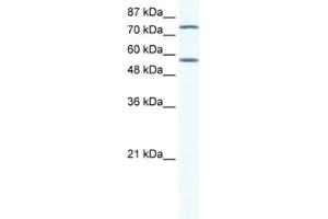 Western Blotting (WB) image for anti-Interferon Regulatory Factor 4 (IRF4) antibody (ABIN2460532) (IRF4 Antikörper)