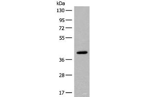 Western blot analysis of Human placenta tissue lysate using FCGRT Polyclonal Antibody at dilution of 1:400 (FcRn Antikörper)