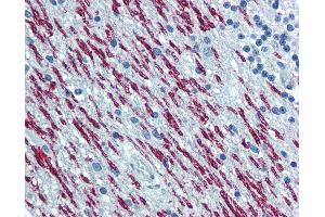 Anti-SPAST / Spastin antibody IHC of human brain, cerebellum.