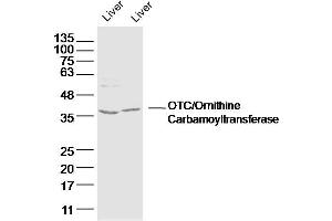 Lane 1: mouse iver lysates Lane 2: rat liver lysates probed with OTC/Ornithine Carbamoyltransferase Polyclonal Antibody, Unconjugated  at 1:300 dilution and 4˚C overnight incubation. (OTC Antikörper  (AA 31-130))