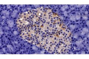 Detection of AST2 in Rat Pancreas Tissue using Polyclonal Antibody to Aspartate Aminotransferase 2 (AST2) (AST2 (AA 30-430) Antikörper)