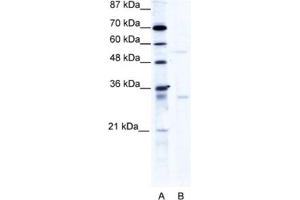 Western Blotting (WB) image for anti-TRIM17 / RNF16 (TRIM17) antibody (ABIN2460982) (TRIM17 / RNF16 Antikörper)