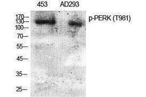 Western Blotting (WB) image for anti-Eukaryotic Translation Initiation Factor 2-alpha Kinase 3 (EIF2AK3) (pThr981) antibody (ABIN3179812) (PERK Antikörper  (pThr981))