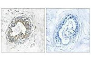 Immunohistochemistry analysis of paraffin-embedded human placenta tissue using PAK1/2 (Ab-199) antibody. (PAK1 Antikörper  (Ser199))