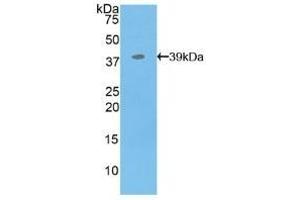 Detection of Recombinant MBP, Human using Polyclonal Antibody to Myelin Basic Protein (MBP) (MBP Antikörper  (AA 220-301))