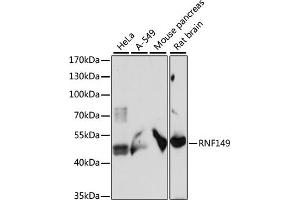 Western blot analysis of extracts of various cell lines, using RNF149 antibody (ABIN7270062) at 1:1000 dilution. (RNF149 Antikörper  (AA 221-400))