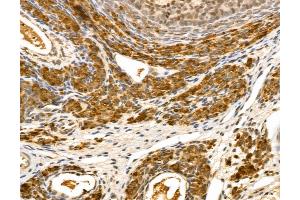 anti-Leucine Zipper Transcription Factor-Like 1 (LZTFL1) (Internal Region) antibody