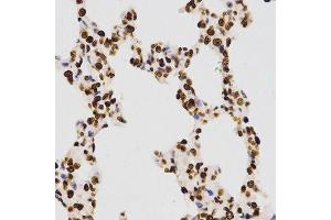 Immunohistochemistry of paraffin-embedded rat lung using DiMethyl-Histone H3-K27 antibody. (Histone 3 Antikörper  (H3K27me))