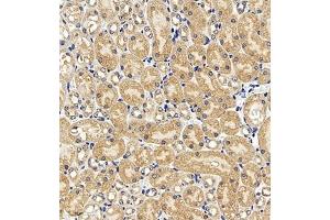 Immunohistochemistry of paraffin embedded mouse kidney using AZI2 (ABIN7072856) at dilution of 1:650 (300x lens) (AZI2 Antikörper)