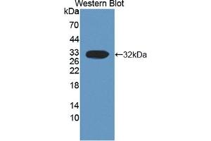 Detection of Recombinant CAPN3, Human using Polyclonal Antibody to Calpain 3 (CAPN3)