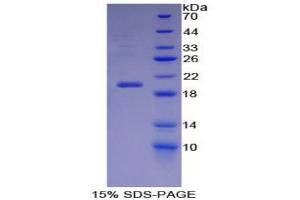 SDS-PAGE analysis of Mouse Carbonic Anhydrase VI Protein. (CA6 Protein)