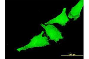 Immunofluorescence of monoclonal antibody to TAOK3 on HeLa cell. (TAO Kinase 3 Antikörper  (AA 809-898))