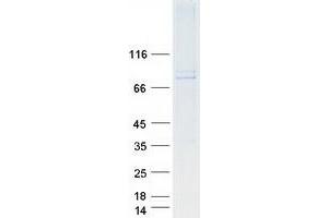 Western Blotting (WB) image for SEC14 and Spectrin Domains 1 (SESTD1) protein (Myc-DYKDDDDK Tag) (ABIN2731859)