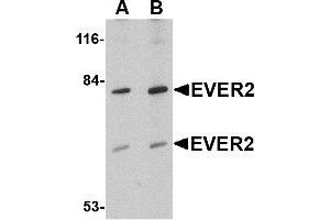 Western Blotting (WB) image for anti-Transmembrane Channel-Like 8 (TMC8) (Middle Region) antibody (ABIN1030928) (TMC8 Antikörper  (Middle Region))