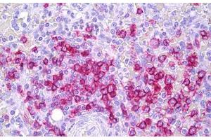 Anti-CD45RB antibody IHC staining of human spleen, lymphocytes. (CD45RB Antikörper)