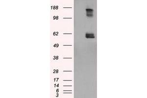 Image no. 1 for anti-Lipase, Endothelial (LIPG) antibody (ABIN1499168)