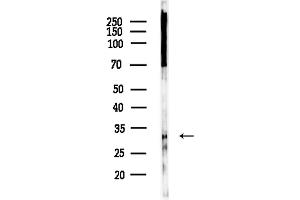 anti-Free Fatty Acid Receptor 2 (FFAR2) (C-Term) antibody