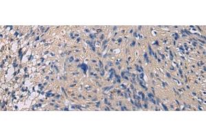 Immunohistochemistry of paraffin-embedded Human brain tissue using CHST3 Polyclonal Antibody at dilution of 1:35(x200)