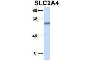 Host:  Rabbit  Target Name:  SLC2A4  Sample Type:  Human Fetal Heart  Antibody Dilution:  1. (GLUT4 Antikörper  (N-Term))
