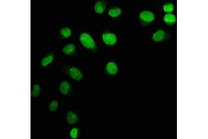 Immunofluorescence staining of Hela cells with ABIN7139603 at 1:12. (HIST1H1C Antikörper  (meLys45))