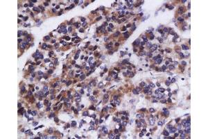 Formalin-fixed and paraffin embedded rat brain tissue labeled with Anti-DCP Polyclonal Antibody, Unconjugated(  at 1:200, followed by conjugation to the secondary antibody and DAB staining (Angiotensin I Converting Enzyme 1 Antikörper  (AA 31-130))