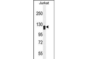 ADCY2 Antikörper  (AA 451-481)