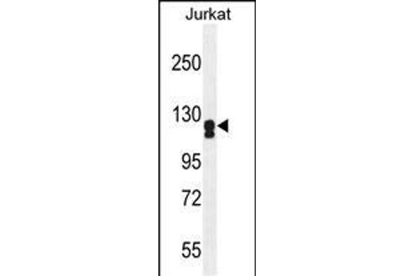 ADCY2 Antikörper  (AA 451-481)