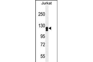 ADCY2 Antibody (Center) (ABIN655269 and ABIN2844861) western blot analysis in Jurkat cell line lysates (35 μg/lane). (ADCY2 Antikörper  (AA 451-481))