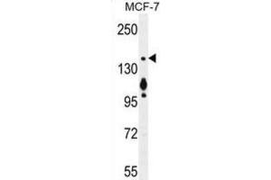 Western Blotting (WB) image for anti-Myosin VI (MYO6) antibody (ABIN2996261) (Myosin VI Antikörper)